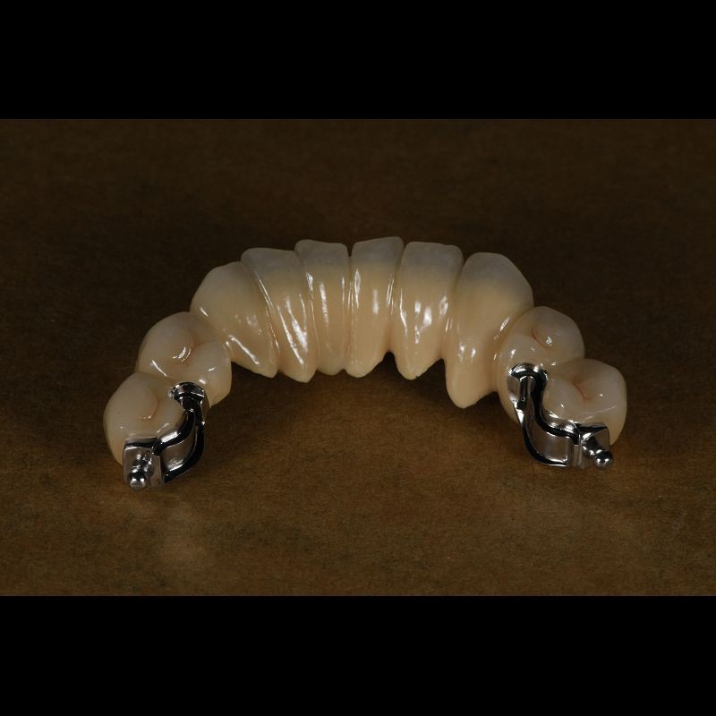 Precision Attachment Partial Dentures