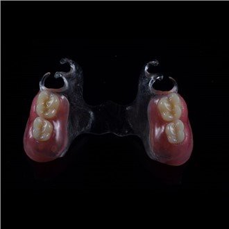 Pròtesis parcial acrílica extraïble