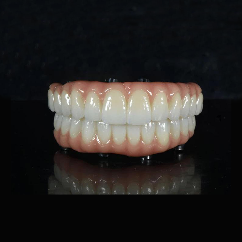 ALL-ON -X PONT DE ZIRCONIA