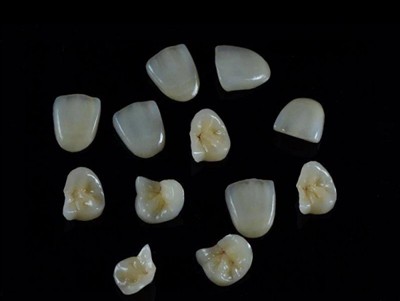 Com triar la millor cola dental per a corones: una guia més recent