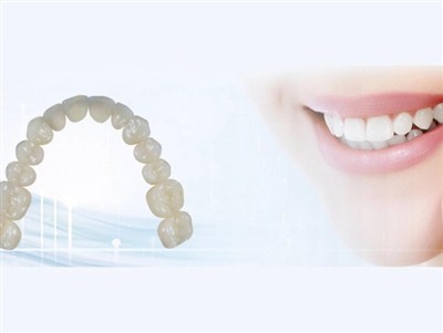 Subcontractació de laboratoris dentals: avantatges, desavantatges i considera...