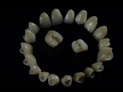 Corones de zirconia de laboratori dental: qualitat, procés i què buscar en un...