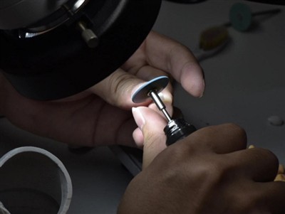 Quant duren les corones PFM? Vida mitjana, factors i consells de cura