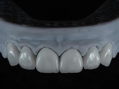 Com externalitzar el treball del tècnic de laboratori dental a l'estranger: u...