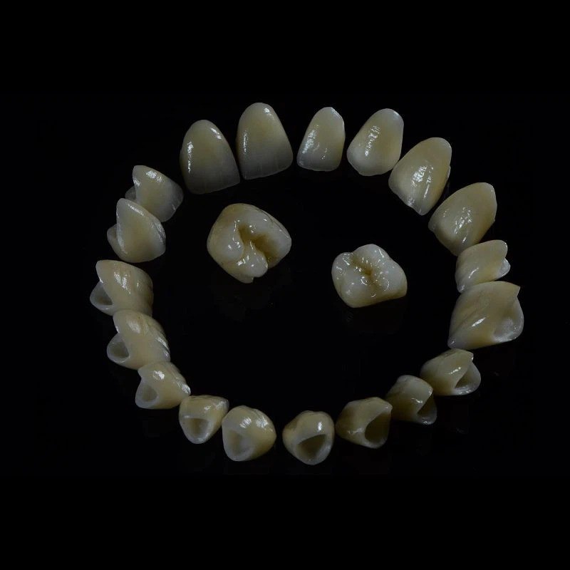 Corona de zirconia en capes