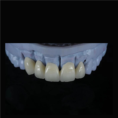 Corona de zirconia estètica i forta